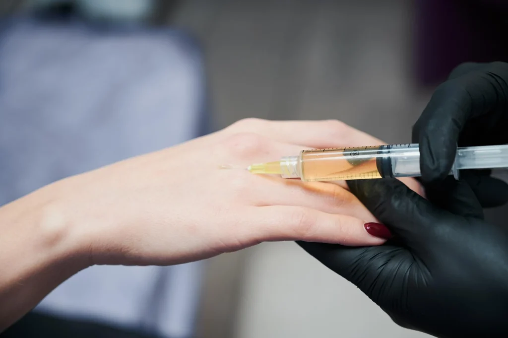 مراقبت های بعد از تزریق مزوژل