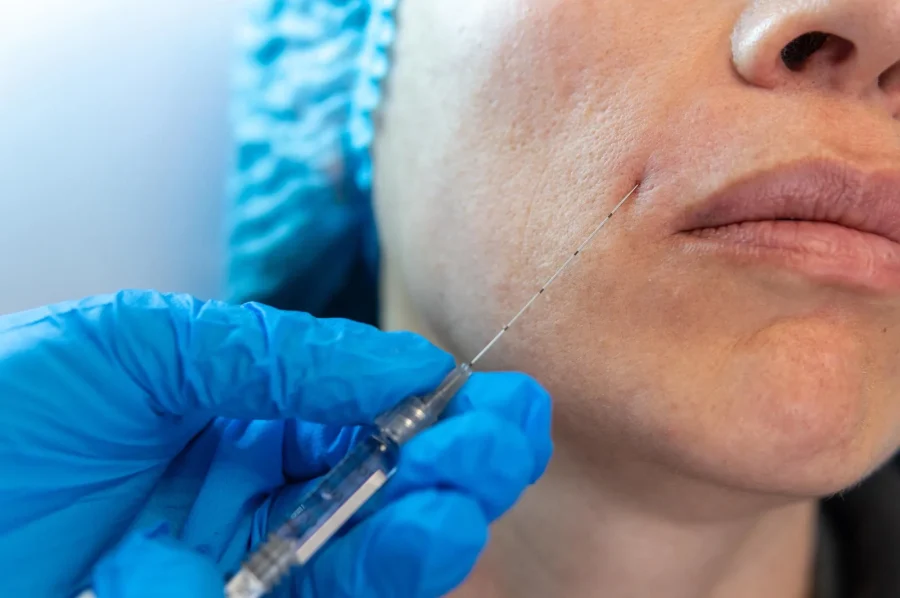 معایب و خطرات تزریق فیلر