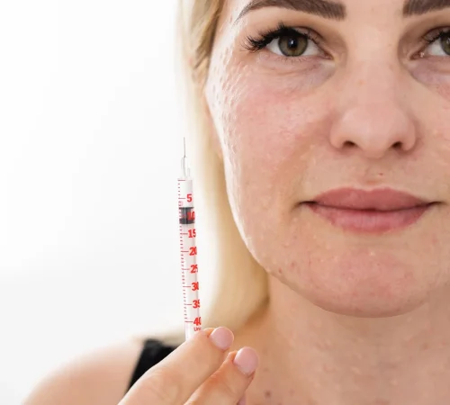 درمان جای جوش با مزونیدلینگ